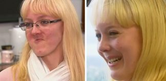 Australčanka prišla kvôli rakovine o čeľusť, teraz ma novú z 3D tlačiarne