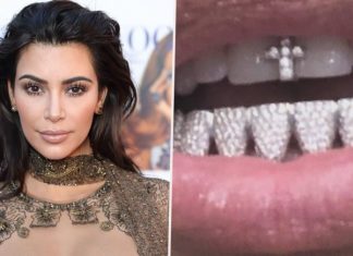 Kim Kardashian ukázala svetu svoj nový diamantový úsmev