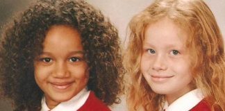 Dvojičky sa narodili s rôznou farbou pleti, v škole ich kvôli tomu dokonca aj šikanovali