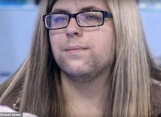 Žene z Ruska po pôrode začali rásť fúzy, jej problém po rokoch vyriešila televízna šou PRED