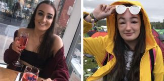 Mladej kráske začala rásť hlava do gigantických rozmerov. Jej kamaráti si z nej robia žarty