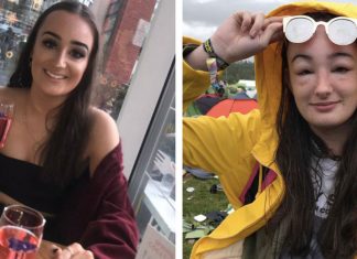 Mladej kráske začala rásť hlava do gigantických rozmerov. Jej kamaráti si z nej robia žarty