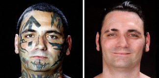 Neuveriteľná premena: Bývalý skinhead si dal odstrániť svoje rasistické tetovania po tom, čo sa stal otcom