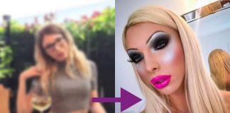 Mladá žena investovala do plastických operácií 17-tisíc eur, aby sa podobala na Paris hilton alebo Britney Spears! Pritom bola predtým tak prirodzene krásna..