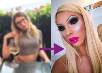 Mladá žena investovala do plastických operácií 17-tisíc eur, aby sa podobala na Paris hilton alebo Britney Spears! Pritom bola predtým tak prirodzene krásna..