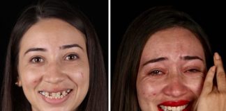 Zubár cestuje po svete a ošetruje chrupy chudobných ľudí. Výsledky jeho práce sú nádherné