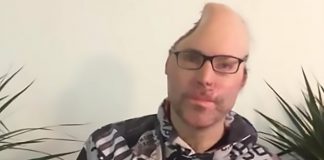 Nemecký rapper prišiel pri výbuchu svojho domáceho drogového labáku o polovicu lebky