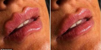 Ženy pobláznili DEVIL LIPS. Podľa nového ruského trendu si ženy po celom svete upravujú tvar pier