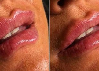 Ženy pobláznili DEVIL LIPS. Podľa nového ruského trendu si ženy po celom svete upravujú tvar pier