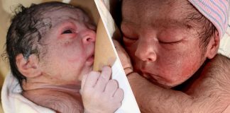 Otec si uťahuje zo svojho novonarodeného synčeka. Náš mini Wolverine sa narodil s bradou!